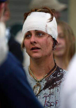 Bloodied Protester